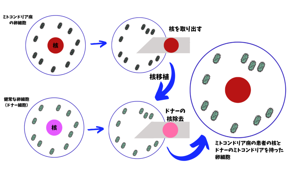 ミトコンドリア置換療法の概要